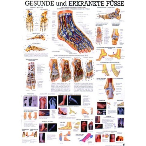 [4954.0] Tafel "Gesunde und erkrankte Füße"